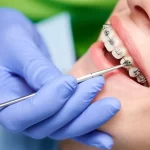 Why Early Dental Care Matters for Children