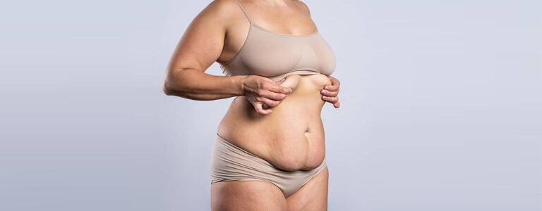 Tummy Tuck with Dr. Nazmi Baycin: Reclaiming a Smooth, Sculpted Abdomen