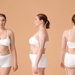 What to Expect from Liposuction Recovery in Newport Beach