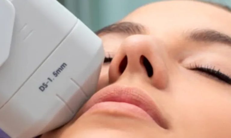 What to Know Before Choosing Ultherapy Facelifting in Singapore