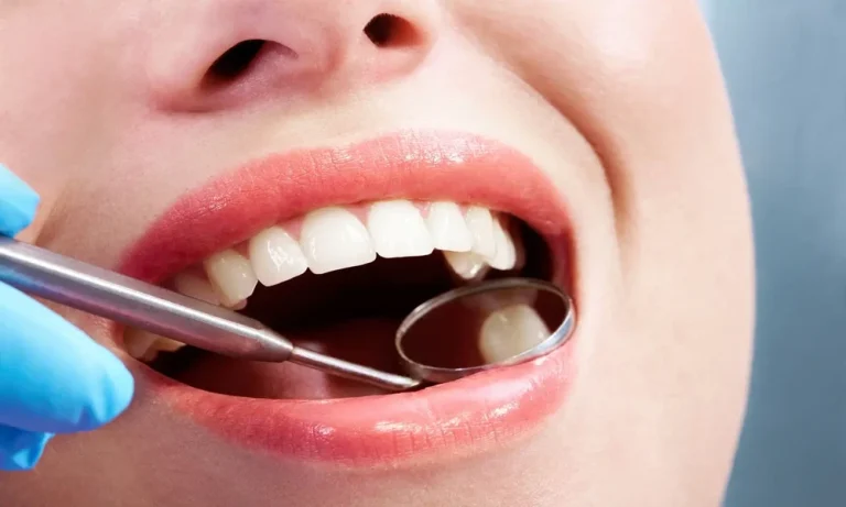 7 Reasons A Conservative Tooth Repair May Be Better Than Full Coverage