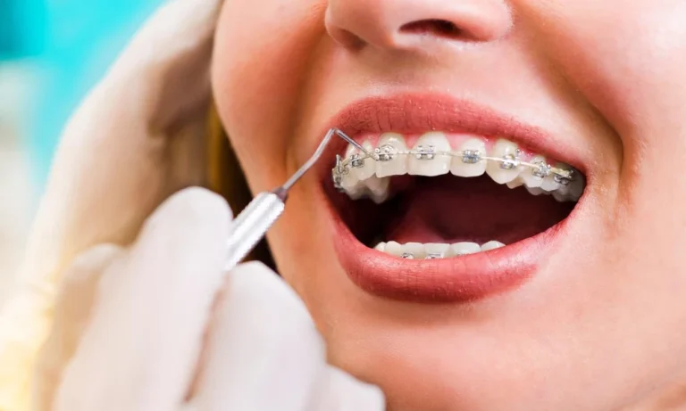 3 Signs Your Child Might Need Orthodontic Intervention Early