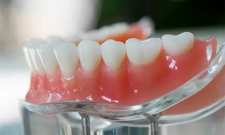8 Hidden Costs of Wearing Dentures Long-Term: What Stubbs Dental and Other Utah Providers Want Patients to Know